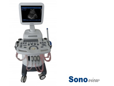 Sonoview