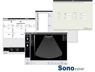 Sonoview