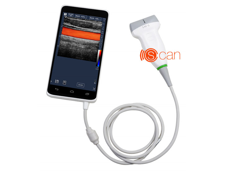 C-Scan